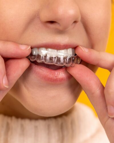 Clear Braces vs. Invisalign - The Pros and Cons - Family Braces