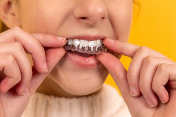Invisalign vs Braces: Which One is Right for You