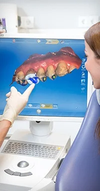CEREC® 1-Day Crowns