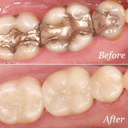 Restorative Dentistry