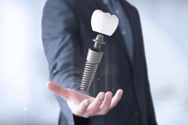 Are Dental Implants Safe?