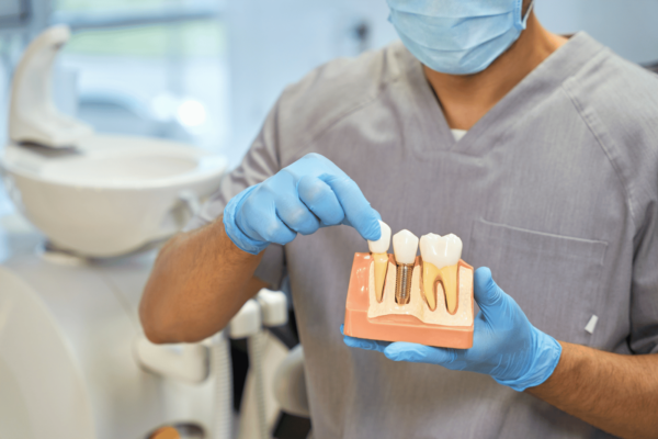 Dental Implants Pains and How To Prevent it!