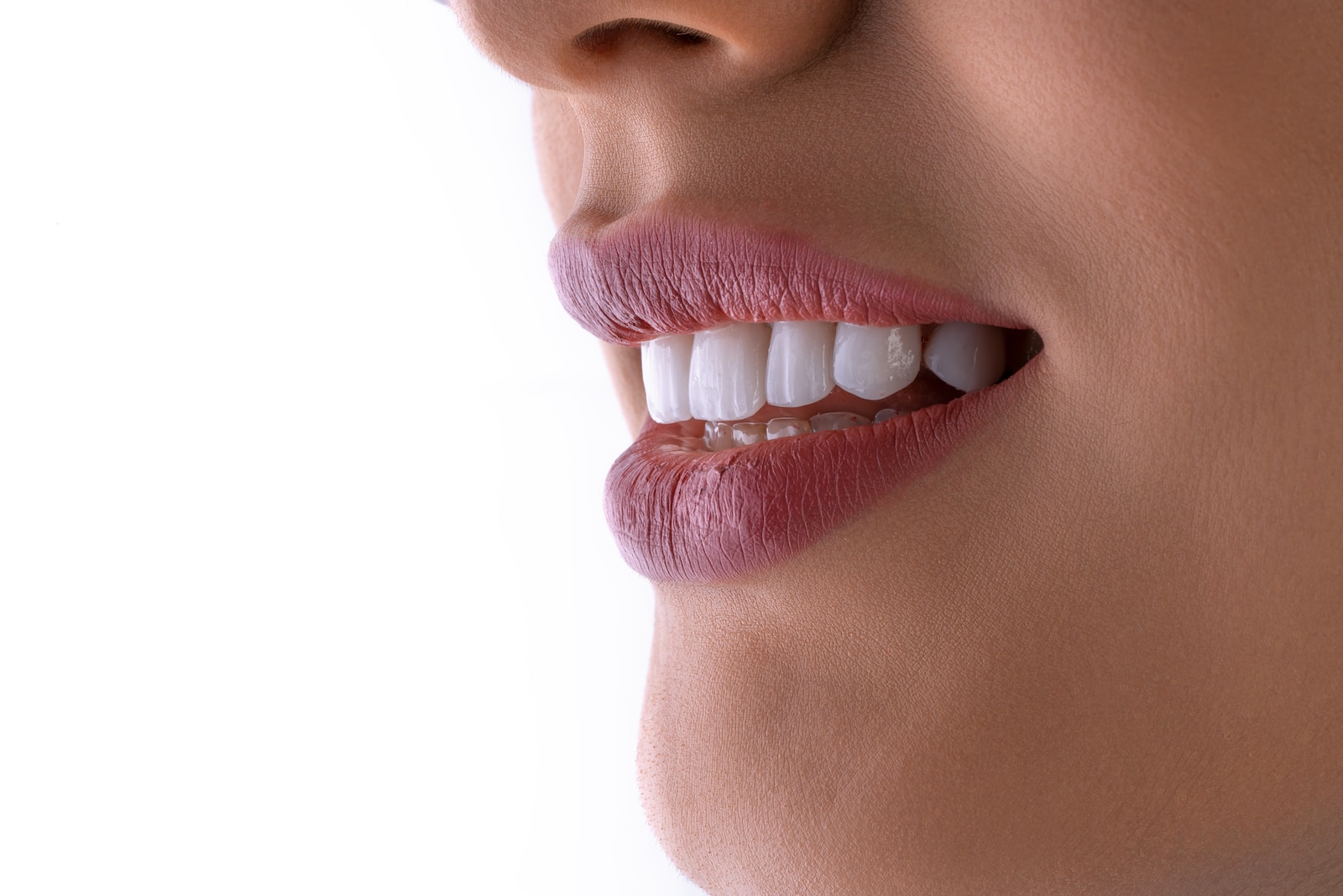 cosmetic dentist, white teeth, in Leesburg, Ashburn