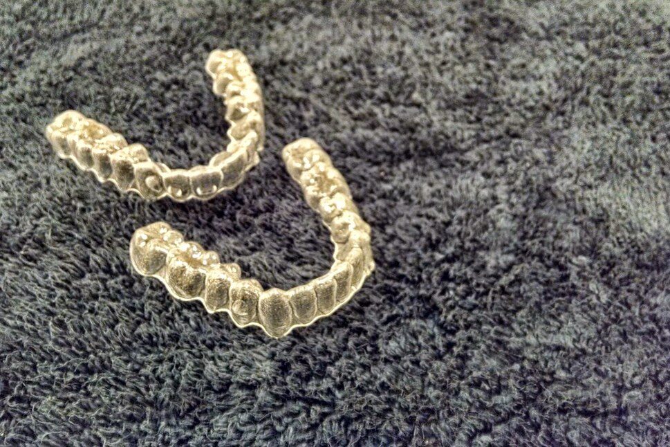 Invisalign Review