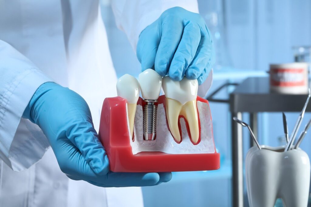 dental implant types