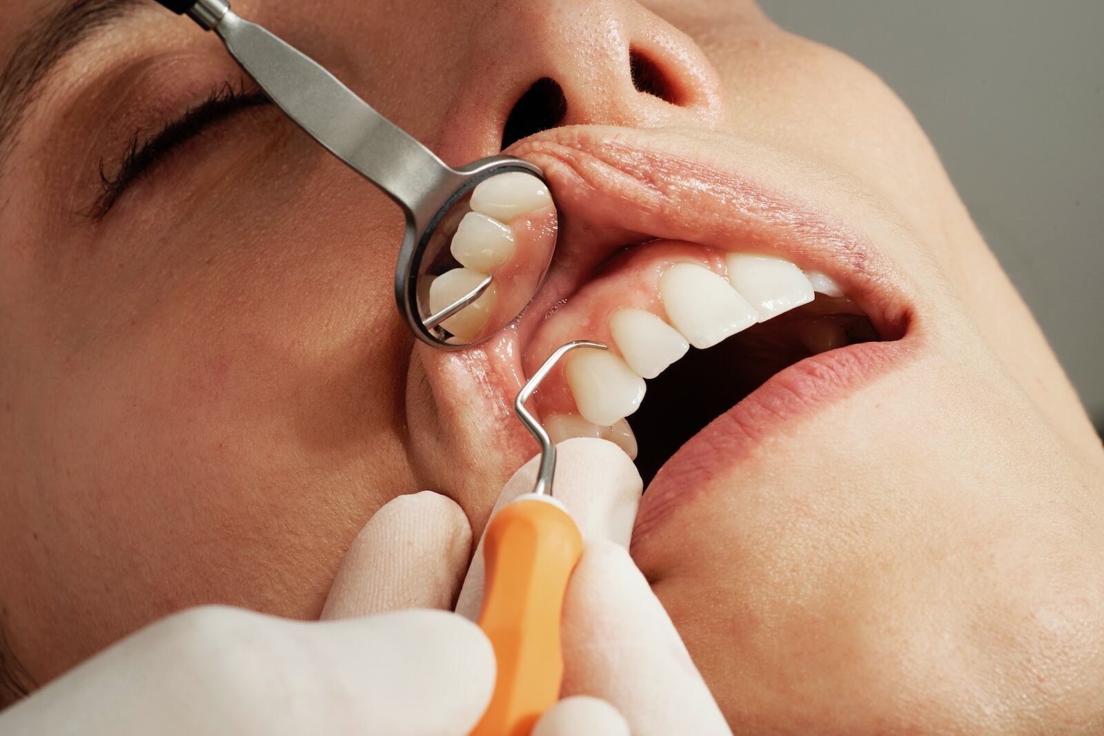Periodontal Therapy in Leesburg, Ashburn