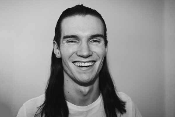 Invisalign Before and After