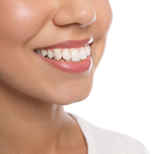 Overbite Treatment - Zara Dental Clinic - Houston 7137661122