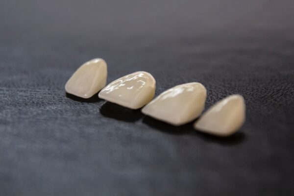 Dental Ceramics Restorations Guide