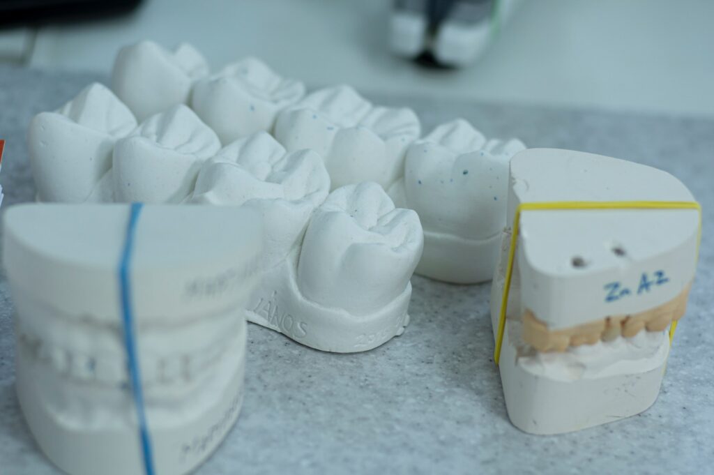 Alternatives to Dental Implants