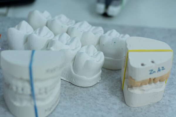 Alternatives to Dental Implants