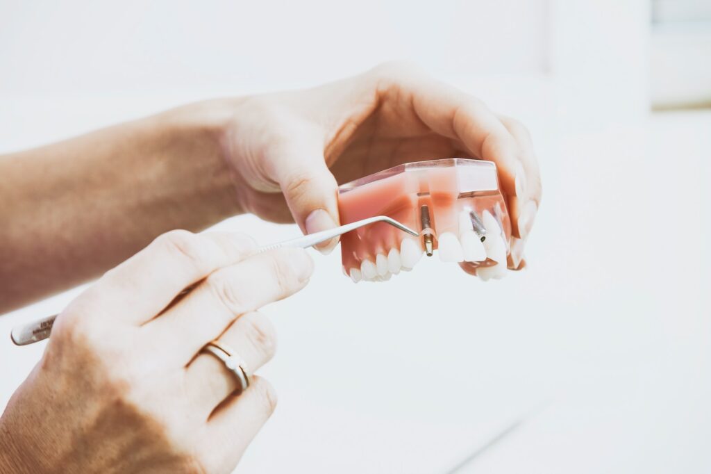 dental implant bone graft explained