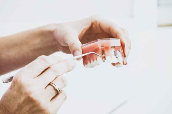 Dental Implant Maintenance Guide: Protect Your Investment