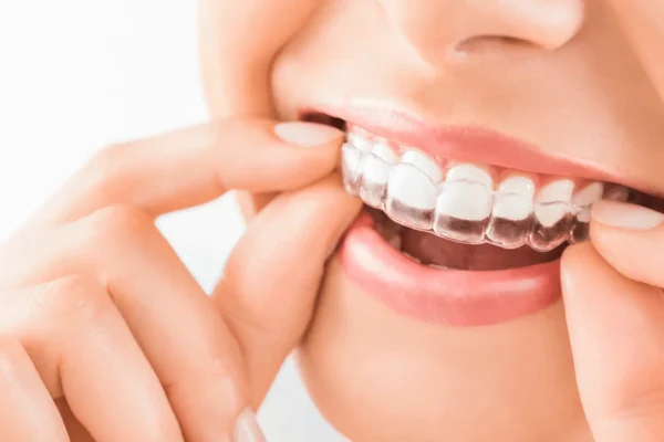 Can I Drink Coffee with Invisalign?