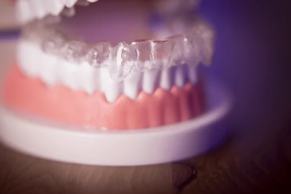 Can Invisalign Change Face Shape?