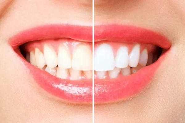 How to Find the Best Leesburg Dentist for Cosmetic Dentistry Treatments?