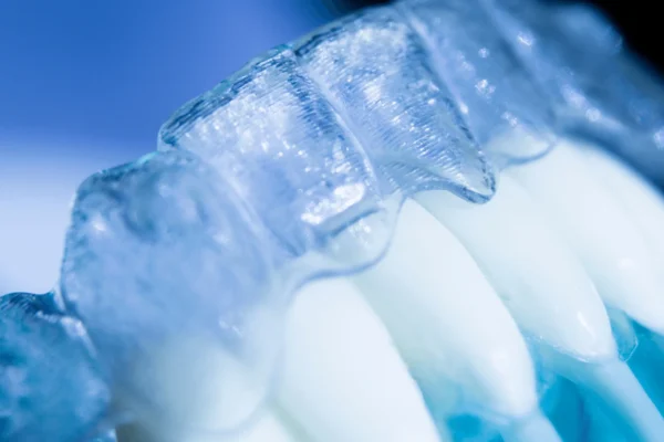 How to Prevent Teeth from Shifting After Invisalign Treatment?